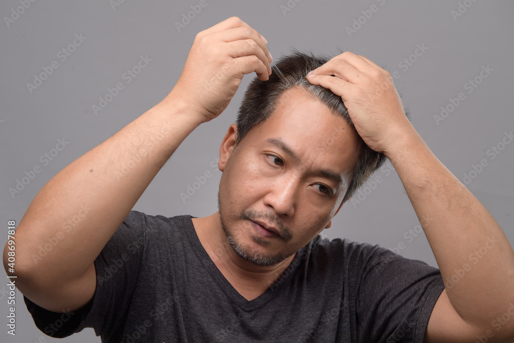 Asian man with hair loss problem receiving serum treatment hair on white background. Middle aged man with gray hair. Hair loss concept. Asian man with hair loss problem receiving serum treatment hair on white background. Middle aged man with gray hair. Hair loss concept.