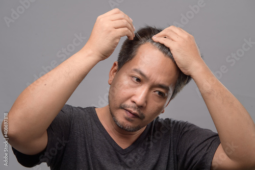 Asian man with hair loss problem receiving serum treatment hair on white background. Middle aged man with gray hair. Hair loss concept.