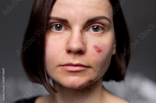Verletzungen im Gesicht