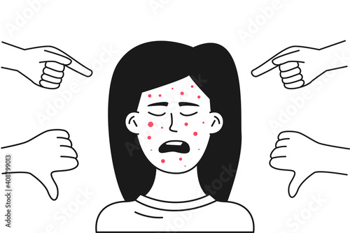 A teenager with acne on her face is subjected to ridicule. Bullying a child because of their appearance.