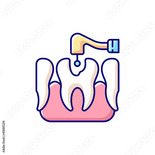 Caries treatment RGB color icon. Tooth recovery stomatology technics. Painless dental treatment. Professional dental care. Crown restoration. Endodontic root canal. Isolated vector illustration