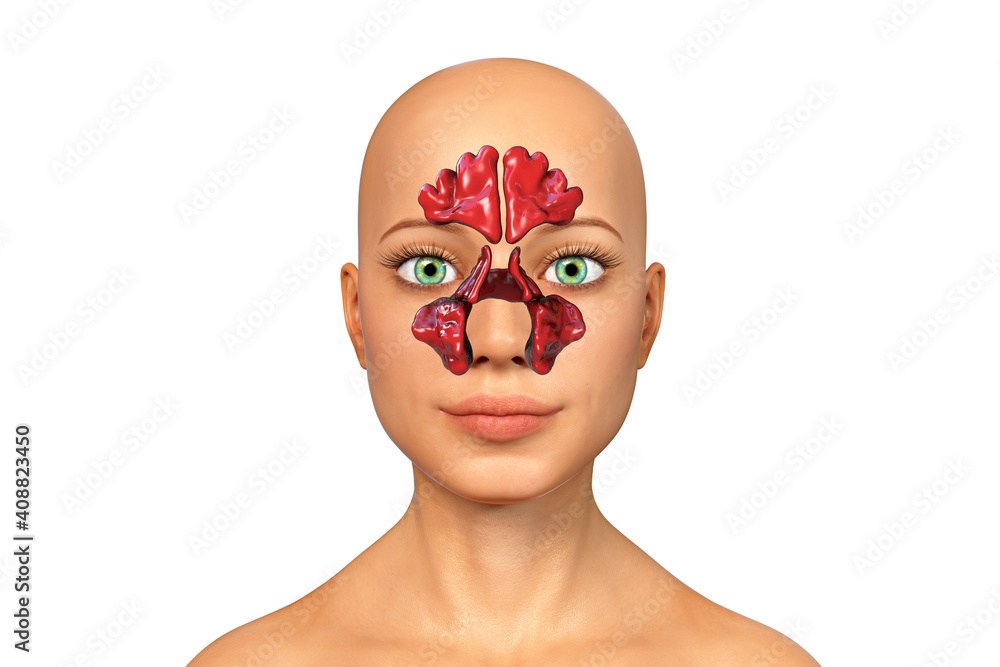 Anatomy of paranasal sinuses Anatomy of paranasal sinuses