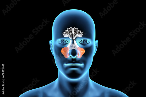Anatomy of paranasal sinuses photo