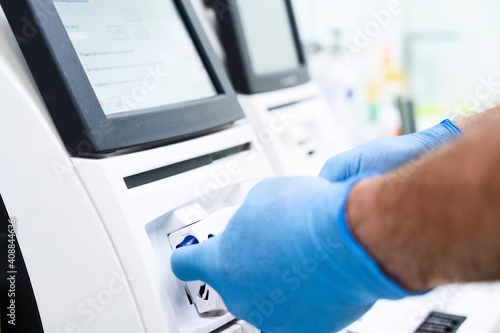 Scientist making a test of blood in laboratory. virus research