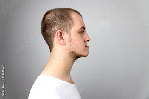 Malocclusion, man in profile. Wrong bite: lower jaw extended forward and retracted. Bite correction with braces. Young man in profile photo