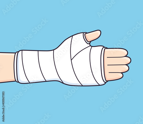 Broken arm, bone fracture, trauma, orthopedic plaster cast.
