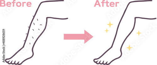 脱毛した足のビフォーアフターイラスト素材