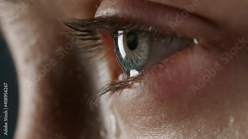 Macro video of allergic woman with tears