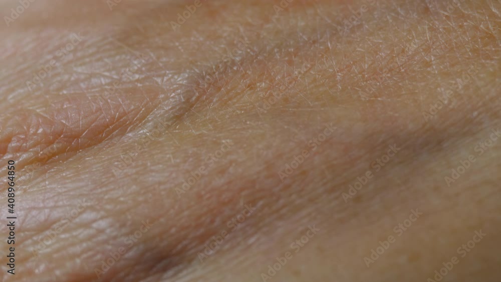 Macro Shot of Really Dry Old Human Skin. Close up Skin Texture With ...