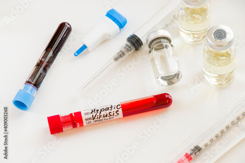 Hepatitis C blood test tube samples in laboratory, Hepatitis C vaccine