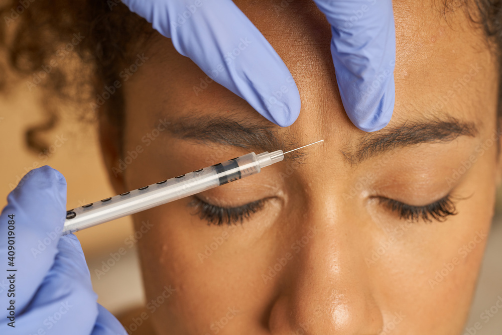 Obraz premium Close up shot of cosmetic injection to the pretty young female face isolated over beige background