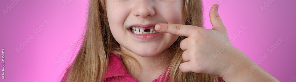 baby teeth. Kid points finger at new teeth baby teeth. Kid points finger at new teeth