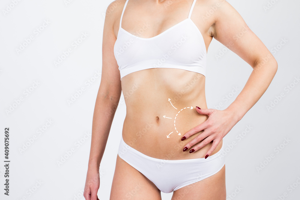 Cellulite removal scheme on body girl. White arrows markings on belly young woman. Live style concept.