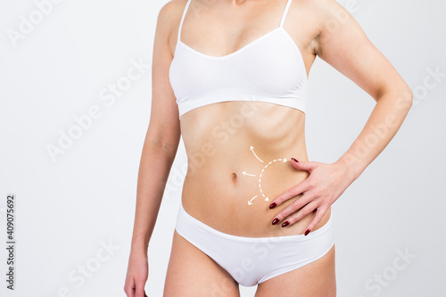 Cellulite removal scheme on body girl. White arrows markings on belly young woman. Live style concept.