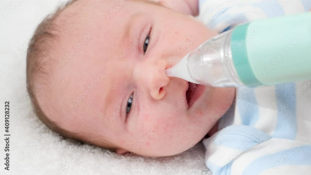 Closeup slow motion of cleaning tiny nose of newborn baby with electric aspirator. Concept of babies and newborn hygiene and healthcare. Caring parents with little children. Closeup slow motion of cleaning tiny nose of newborn baby with electric aspirator. Concept of babies and newborn hygiene and healthcare. Caring parents with little children.