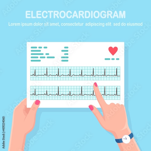 Cardiogram in doctor hand. Diagnosis cardiovascular disease. Chart of heart beat rhythm. Ecg document. Vector illustration