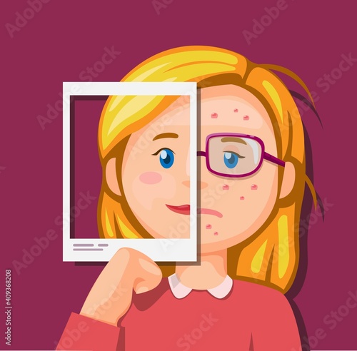Girl beauty and ugly comparison in photo or social media. pimple acne problem and cosmetic product illustration concept in cartoon vector