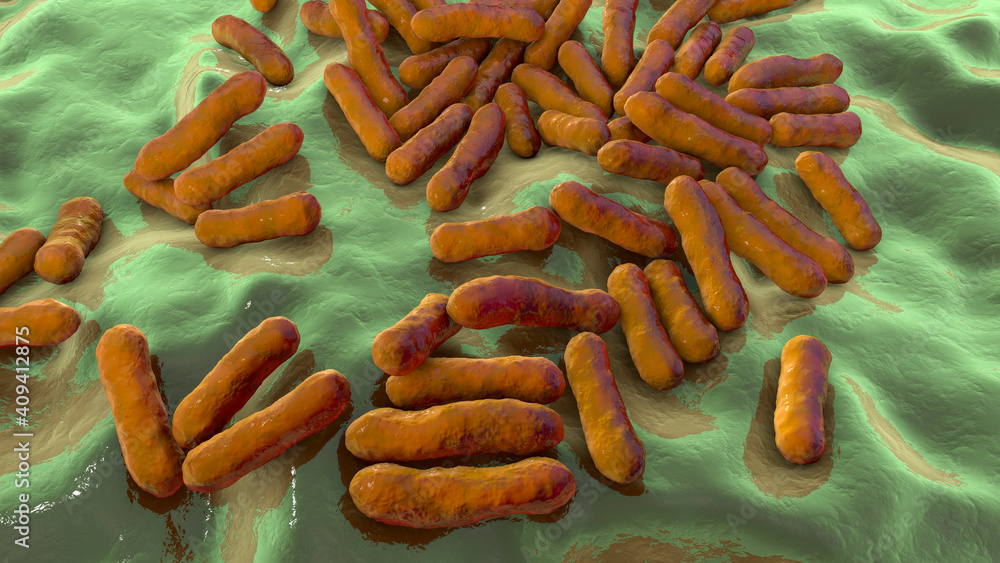 Cutibacterium acnes, formely Propionibacterium acnes Cutibacterium acnes, formely Propionibacterium acnes