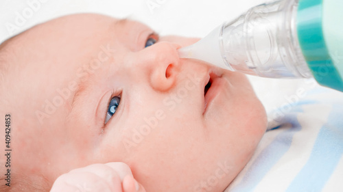 Closeup of using nasal aspirator for cleaning newborn baby nose from mucus. Concept of babies and newborn hygiene and healthcare. Caring parents with little children. photo