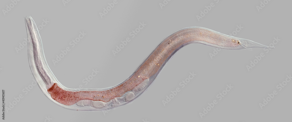 Nematode under microscope