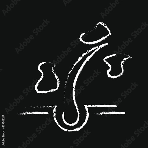 chalk icon, dandruff on hair