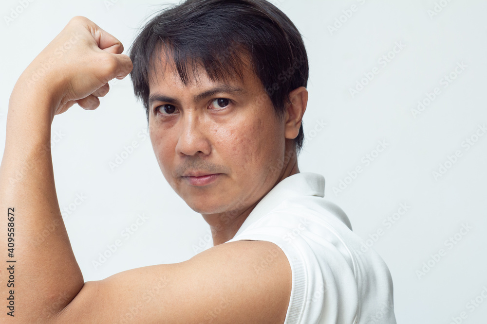 man show his arm to get vaccine