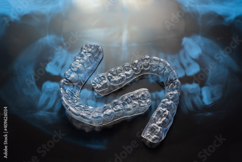 Transparent bite correction trays and x-ray of the jaw. Orthodontist equipment photo