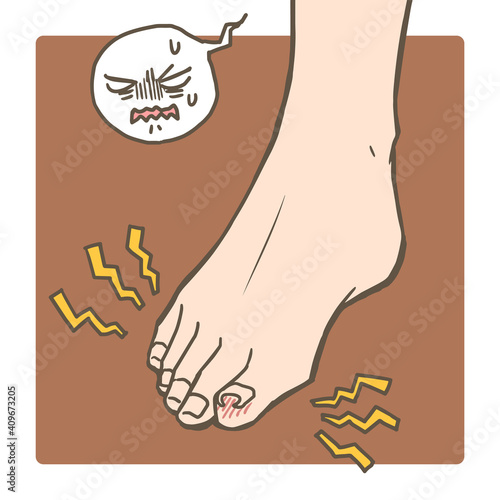 足のトラブル_巻き爪