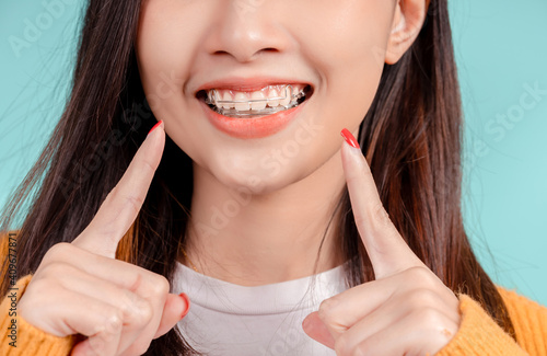 Dental Beautiful smiling of young asian woman with retainer braces glad emotion with white teeth increase confidence for healthy on blue background isolated, Happiness teenager facial expression.