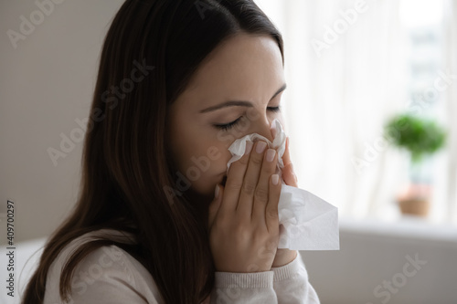 Close up of unhealthy young Caucasian woman blow in napkin suffer from flu or cold. Unwell sick millennial female snuffle struggle with virus symptoms, have runny nose. Corona, covid-19 concept.