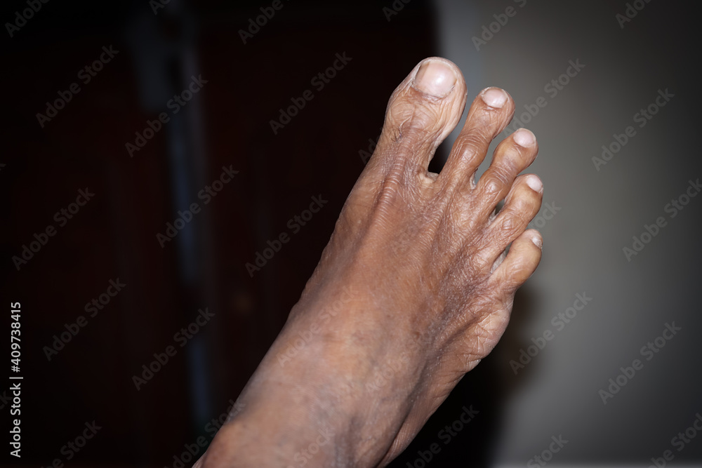 Fototapeta premium Wrinkled Foot