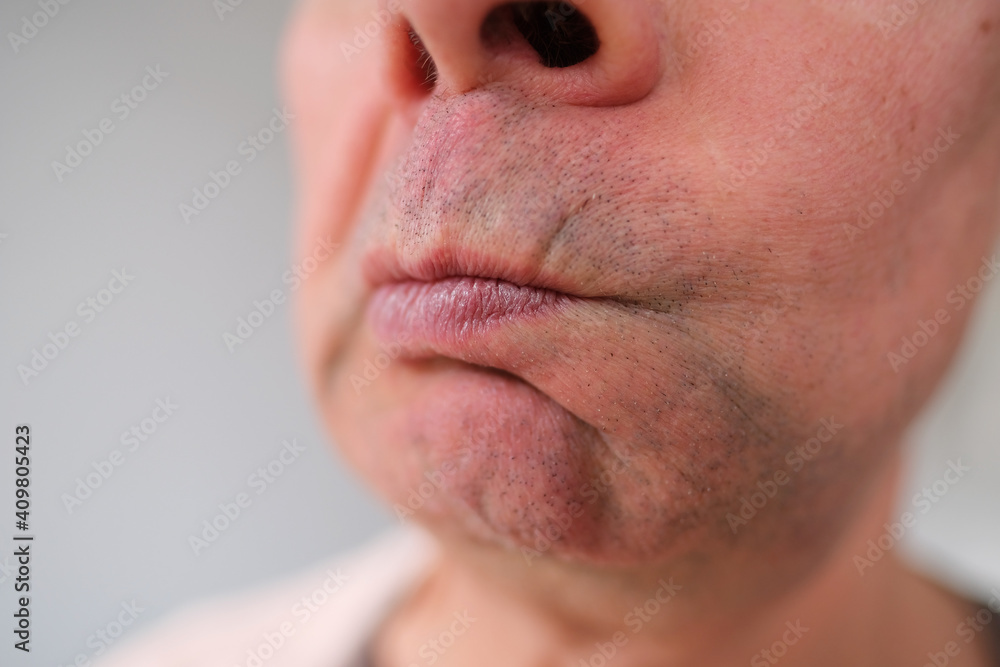 close-up and front view of mouth of an old caucasian man in his sixties, with strong wrinkles, bright emotions on his face, male skin care concept close-up and front view of mouth of an old caucasian man in his sixties, with strong wrinkles, bright emotions on his face, male skin care concept