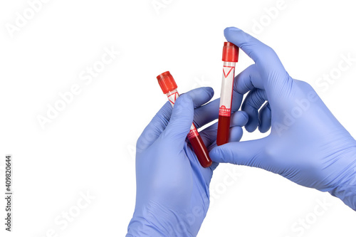 Hand holding test tube with blood plasma ready for testing