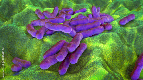 Cutibacterium acnes, formely Propionibacterium acnes photo