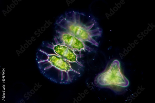 Protozoa and Green Algae in waste water under the microscope.
 photo