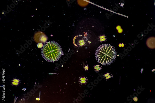 Protozoa and Green Algae in waste water under the microscope.
