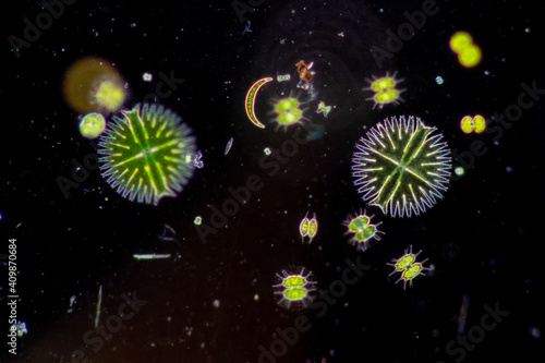 Canvastavla Protozoa and Green Algae in waste water under the microscope.