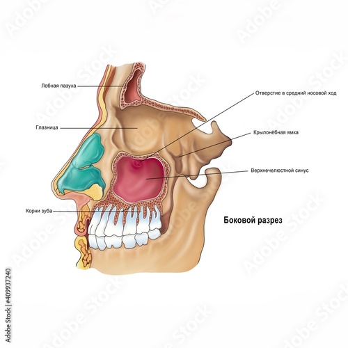 Human anatomy, anatomical plaque paranasal sinuses, lateral incision photo