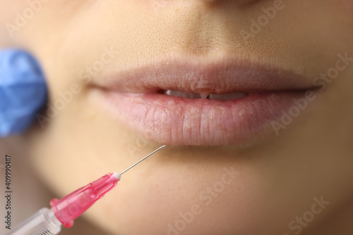 Beautician doctor making injection of patients lips closeup