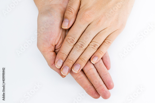 Women's hands without manicure on nails on a white background