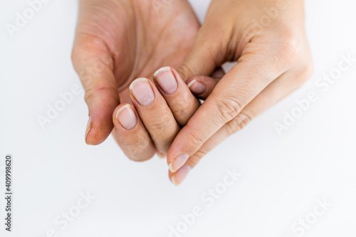 Women s hands without manicure on nails on a white background