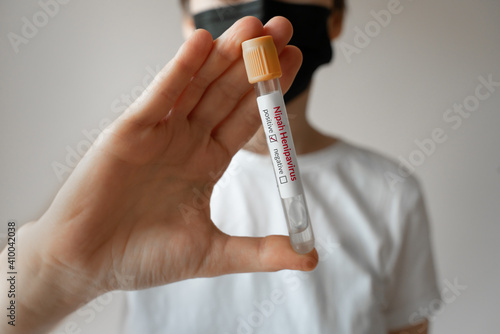 Nipah virus. Young woman wearing a medical face mask holding a glass test tube. Nipah Henipavirus is a newly emerging bat-borne virus that causes acute respiratory illness. nipah virus infection