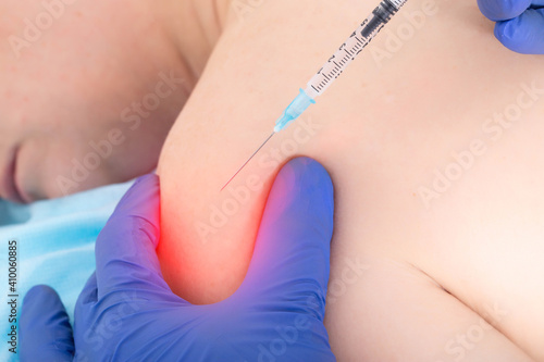 The doctor injects an anti-inflammatory drug into the shoulder joint where there is pain and inflammation. Treatment concept for arthrosis and bursitis photo