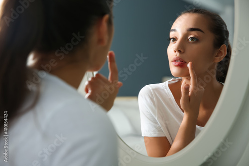 Obraz na płótnie Young woman with herpes applying cream on lips in front of mirror at home