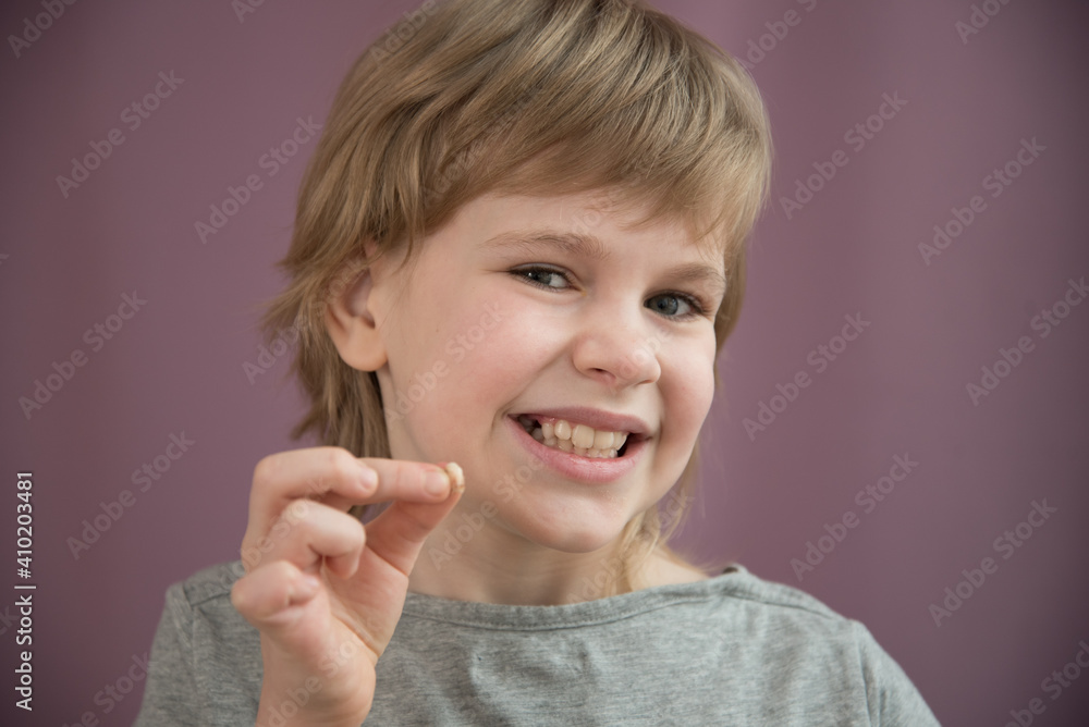 The child holds a lost tooth in his hand. There are traces of caries on the tooth. Removal of a
