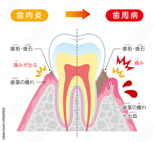 Tooth cross section_24