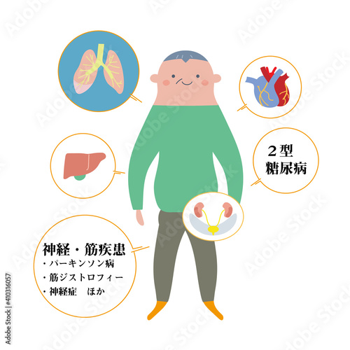 シニア男性をモデルにした基礎疾患の説明図　イラスト

