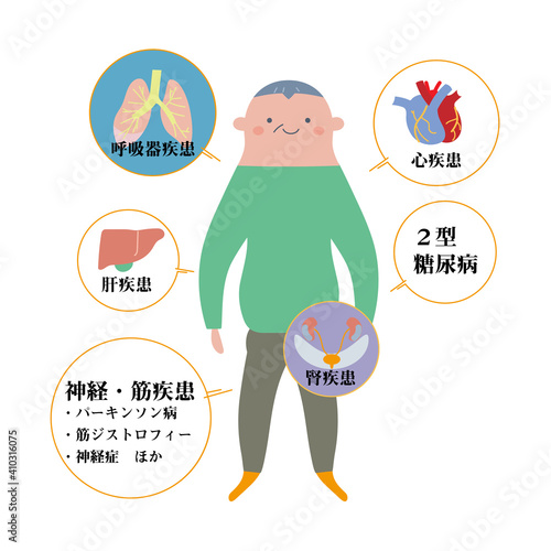 シニア男性をモデルにした基礎疾患の説明図　イラスト
