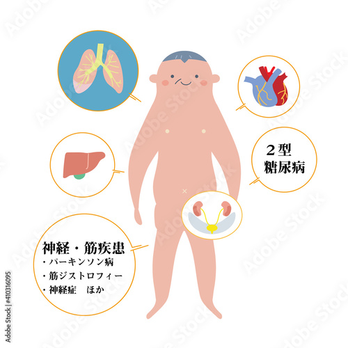 シニア男性をモデルにした基礎疾患の説明図　イラスト
