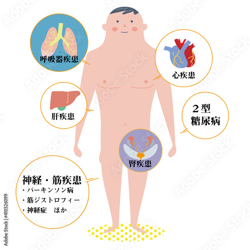 働ぎ盛りの基礎疾患説明図　イラスト
